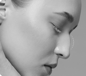  - قبل از درمان