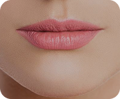 تزریق فیلر لب متد روسی - قبل از درمان