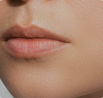 تصویر قبل از درمان