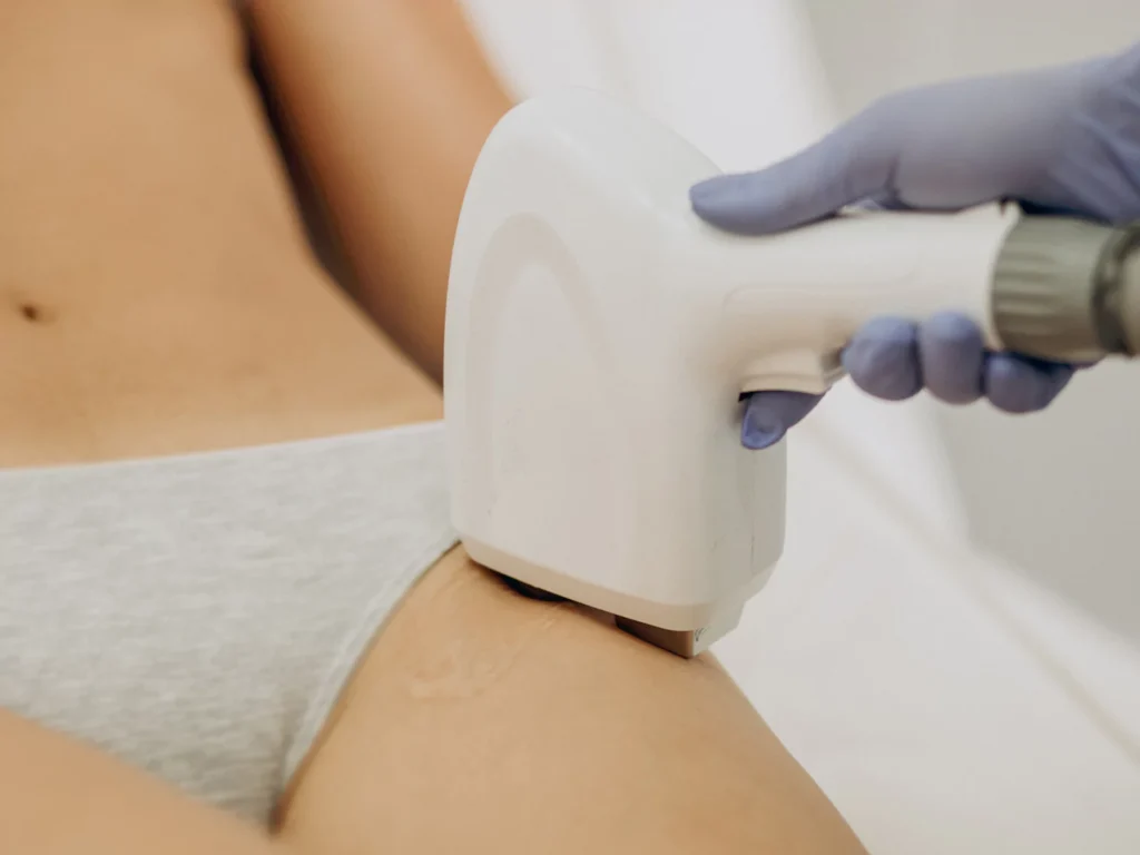 لیزر موهای زائد بیکینی چگونه انجام می شود