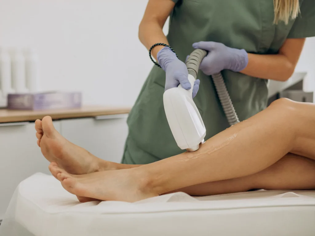 لیزر موهای زائد چگونه است